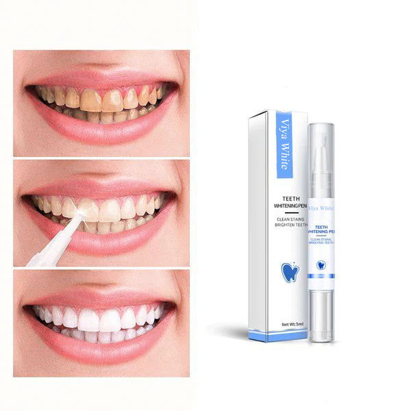 PearlWhite – Fast Teeth Whitening For A Radiant Smile